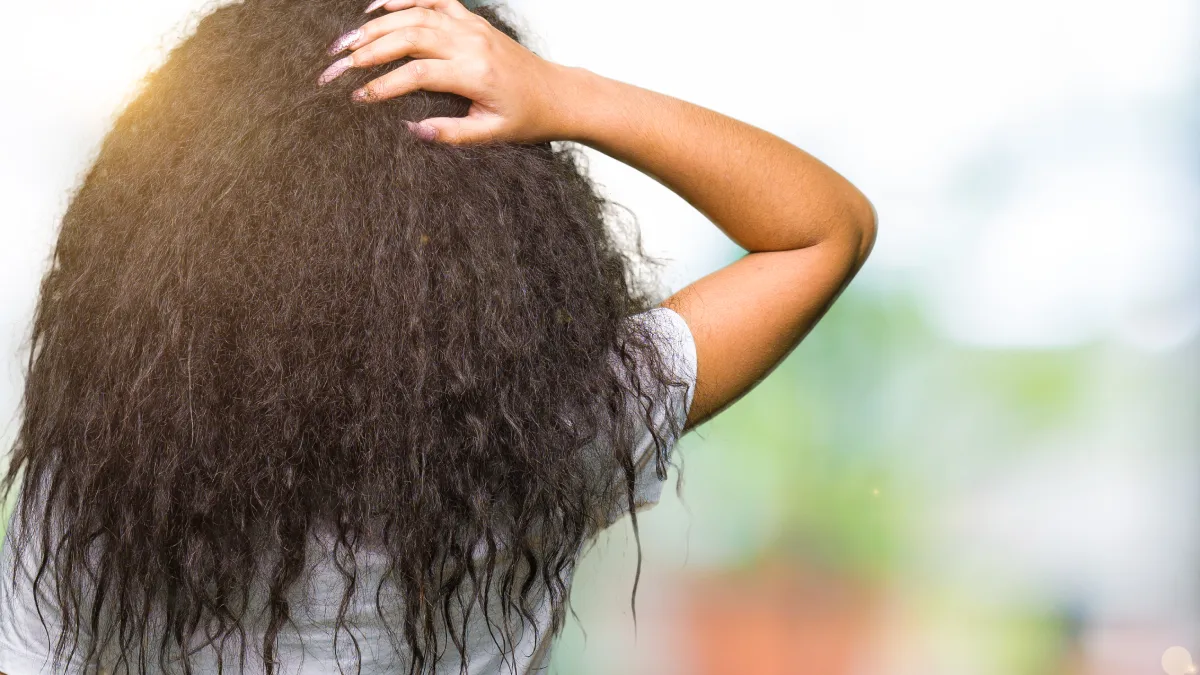 Pourquoi Calecim Professional constitue une meilleure alternative à la thérapie PRP pour les soins capillaires